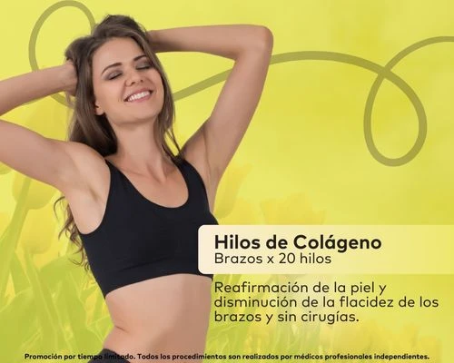 Hilos de Colágeno en Brazos