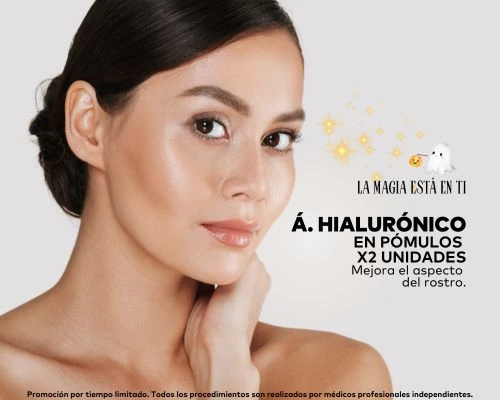 Ácido hialurónico Pómulos X 2 Unidades X 1 Sesión
