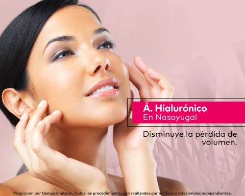 Ácido Hialurónico Nasoyugal