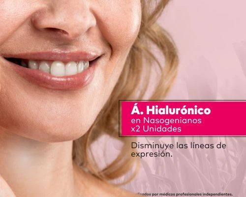 Acido hialurónico para Nasogeniano