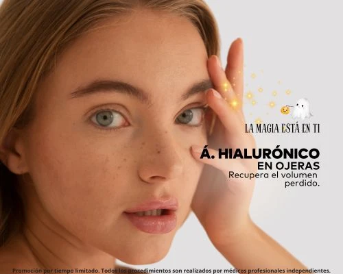 Ácido Hialurónico Ojeras X 1 Sesión
