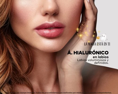 Ácido Hialurónico Labios X 1 Sesión