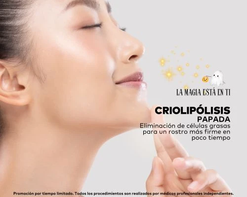 Criolipólisis en Papada