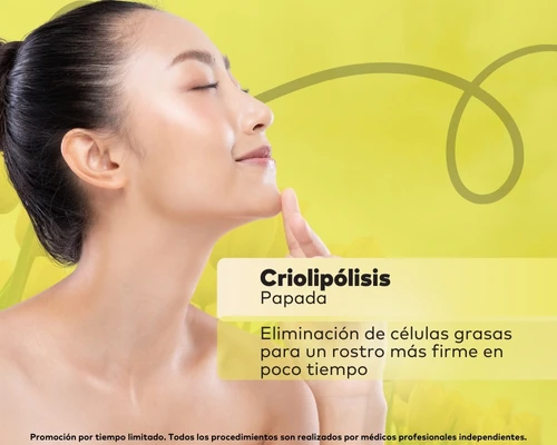 Criolipólisis en Papada