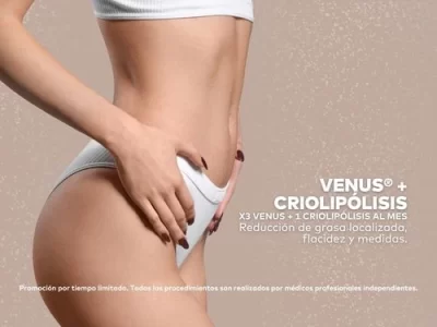 Tratamiento de Venus y Criolipolisis en Promoestetica
