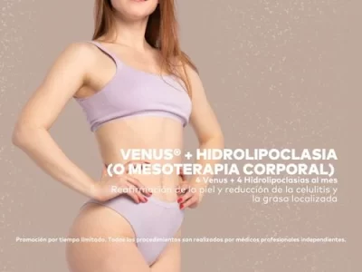 Venus con Hidrolipoclasia en Promoestetica