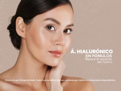 Ácido Hialurónico para Pómulos en Promoestetica
