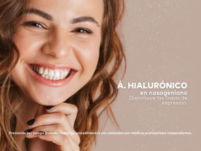 Acido Hialuronico en Nasogenianos en Promoestetica