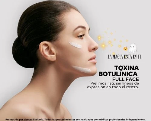 Toxina Botulínica Full Face Facial X 1 Sesión