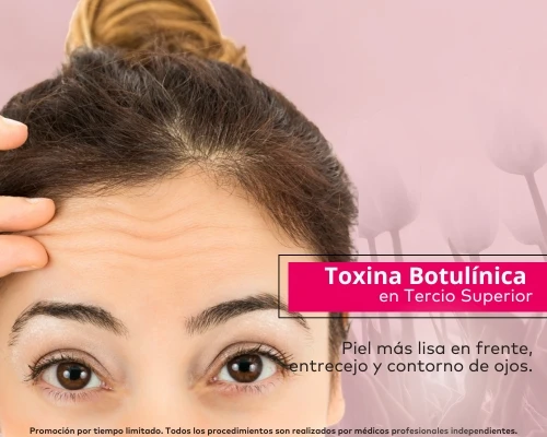 Toxina Botulínica Tercio Superior