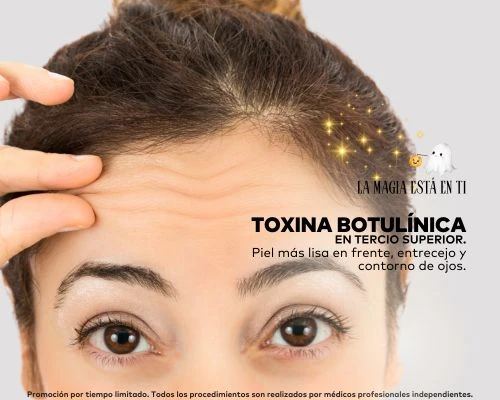 Toxina Botulínica Tercio Superior