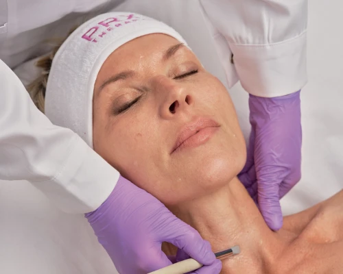 Resultados 2 de rejuvenecimiento facial con PRX PLUS