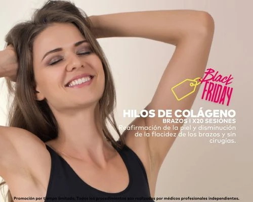 Hilos de Colágeno en Brazos