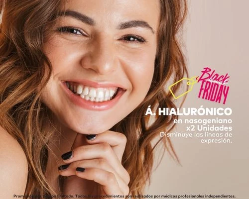 Acido hialurónico para Nasogeniano