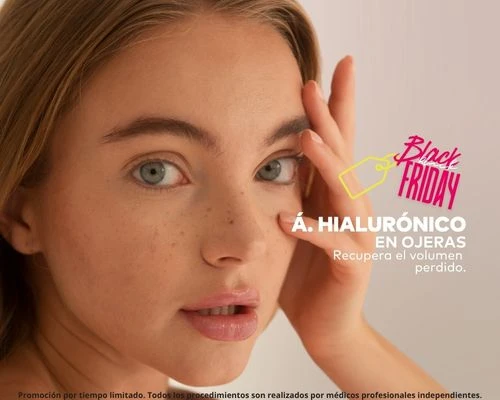 Ácido Hialurónico para ojeras