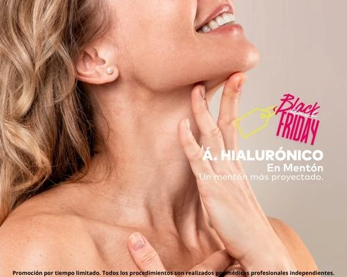 Acido hialuronico para menton