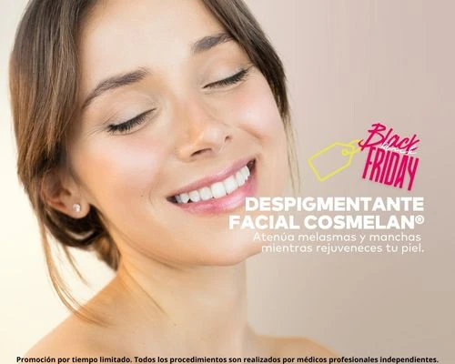 Cosmelan tratamiento despigmentante