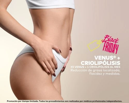 Venus® y Criolipólisis