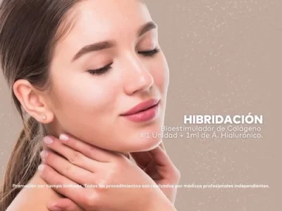 Hibridación en Promoestética