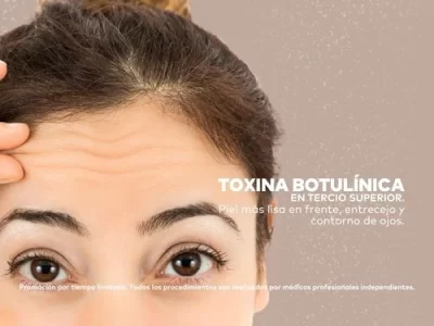 Toxina Botulínica en Tercio Superior en Promoestetica