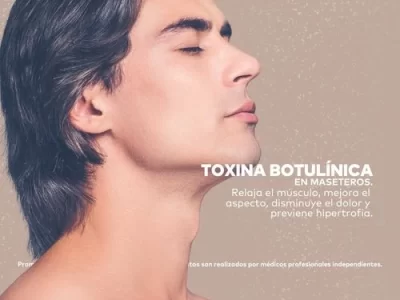 Toxina Botulínica en Maseteros en Promoestetica